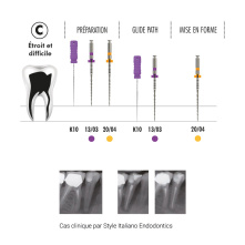 FANTA Limes Endo - F-One Essential 13/03% - Réassort - by Style Italiano Endodontics FANTA Limes Endo - F-One Essential 13/03% - Réassort - by Style Italiano Endodontics