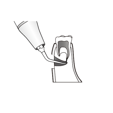 DTE WOODPECKER - Tip ED22D