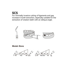 Insert dentaire extraction WOODPECKER DTE - SC5 - wamkey.com Insert dentaire extraction WOODPECKER DTE - SC5 - wamkey.com