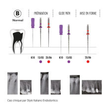 FANTA Limes Endo - Kit F-One Essential - Séquence by Style Italiano Endodontics FANTA Limes Endo - Kit F-One Essential - Séquence by Style Italiano Endodontics