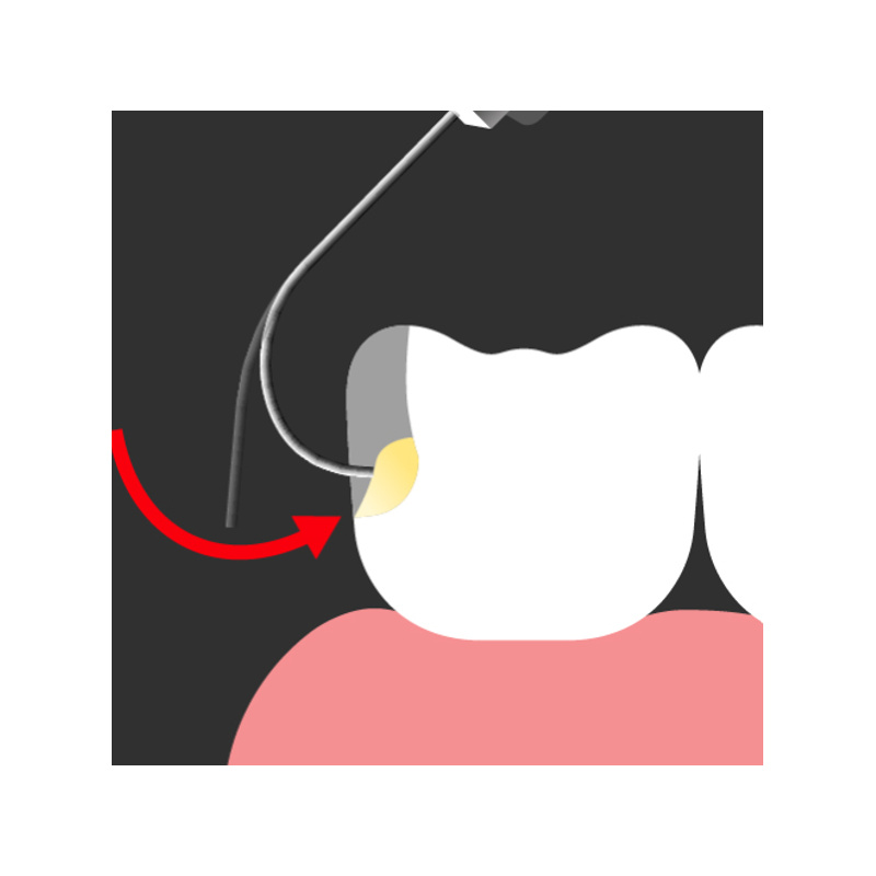 SPIDENT- Injectable Composite EsFlowPlus
