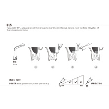 Insert Woodpecker & DTE