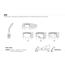 Insert Woodpecker & DTE