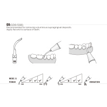 Insert Woodpecker & DTE GS6 Insert Woodpecker & DTE GS6