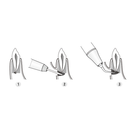 DTE WOODPECKER - Tip ED19D