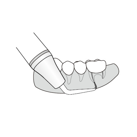 DTE WOODPECKER - Tip ED21RD