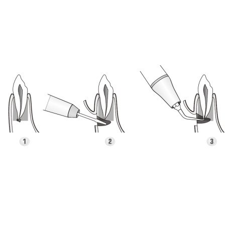 DTE WOODPECKER - Tip ED23D