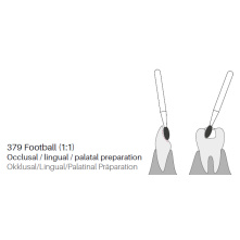 GZ BURS- ZD Diamonds Football ZD379- x5