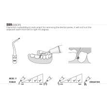 Kit Inserts ultrasons - Excavation a minima de WOODPECKER DTE