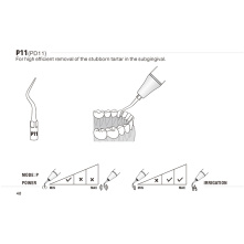 Kit Surfaçage Radiculaire - inserts à ultrasons WOODPECKER DTE