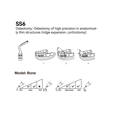 DTE WOODPECKER - Tip SS6