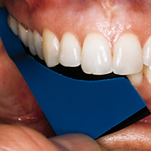 DIRECTA - Papiers à articuler TrollFoil mini - 8µ 100pcs