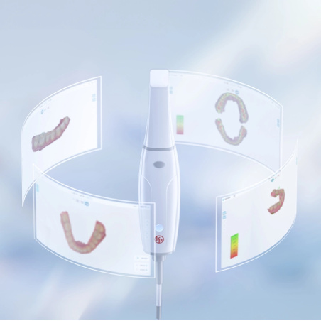 KEVIN PETER by Woodpecker - Scanner intra-oral Smile Scan