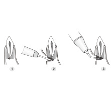 DTE WOODPECKER - Kit Apical Surgery - DTE® or SATELEC® compatibility ED19D ED20D ED23D ED21LD ED21RD