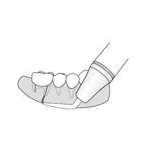DTE WOODPECKER - Kit Apical Surgery - DTE® or SATELEC® compatibility ED19D ED20D ED23D ED21LD ED21RD
