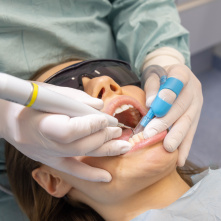 ERGOFINGER - Embout d'aspiration autonome HVE + Adaptateur