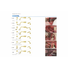 Woodpecker surgery x piezo motor WAM Woodpecker surgery x piezo motor WAM