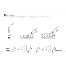 Insert Woodpecker & DTE G5 Insert Woodpecker & DTE G5