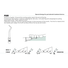 Insert Woodpecker & DTE Insert Woodpecker & DTE