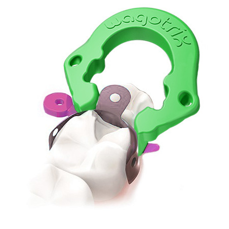 WagoTrix Sectional Matrix Essential Kit