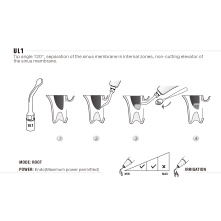 Insert WOODPECKER DTE - UL1