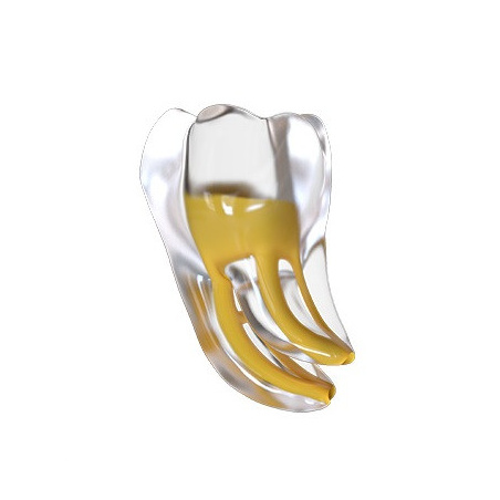 FANTA - Endo training tooth