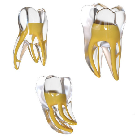 FANTA - Endo training tooth