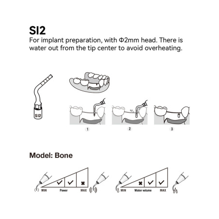 DTE WOODPECKER - TIP SI2