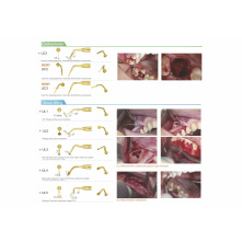 DTE WOODPECKER - ULTRA SURGERY PIEZO MOTOR