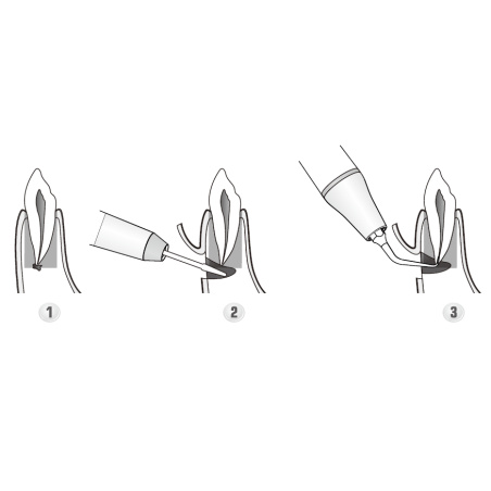 DTE WOODPECKER - INSERT ED24D