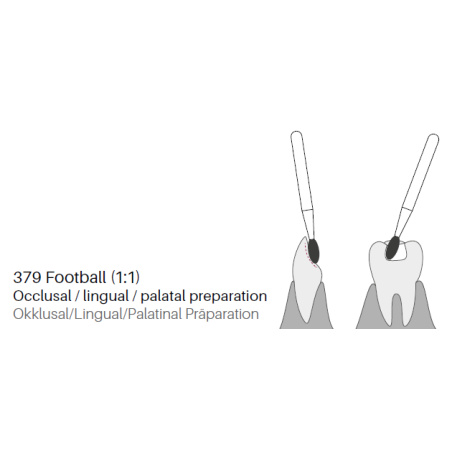 GZ BURS- ZD Diamonds Football ZD379- x5