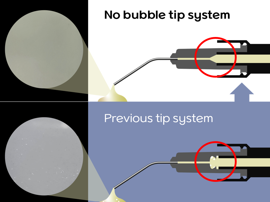 injectable%20systeme%20anti%20bulle%20EN.png