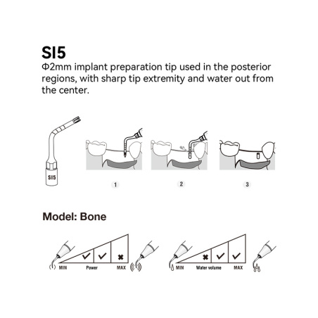 DTE WOODPECKER - Tip SI5